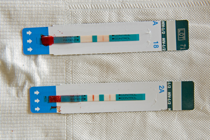 Rapid HIV test results: a visual line indicates &lt;p&gt;that the child is HIV positive